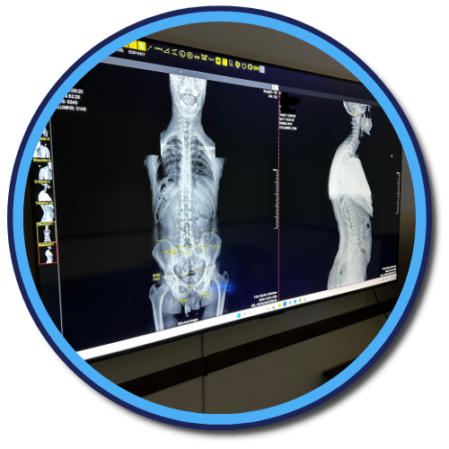 Gonstead X-Rays Nervo Chiropractic