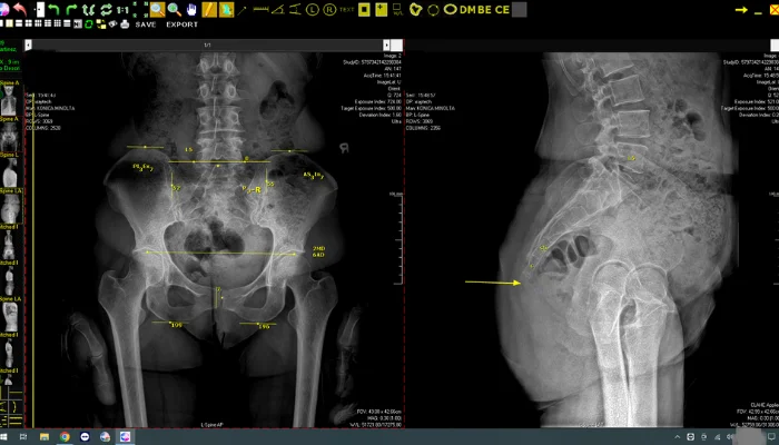 second tustin chiropractic visit
