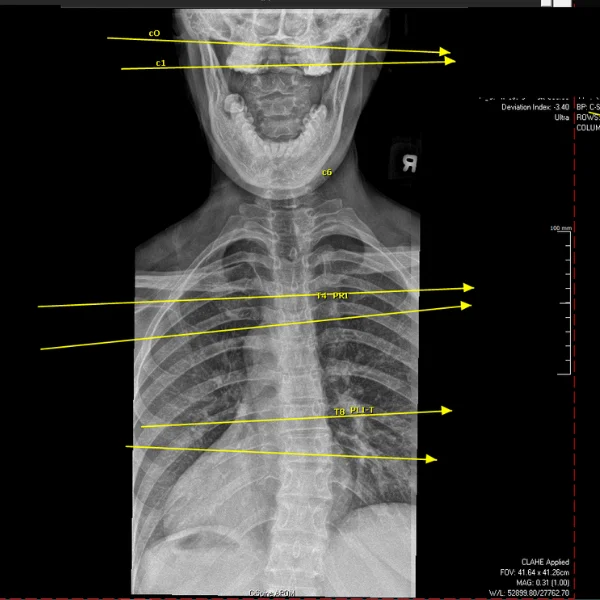 Nervo Chiropractic in Tustin CA