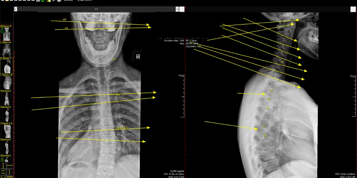 best chiropractor in tustin california
